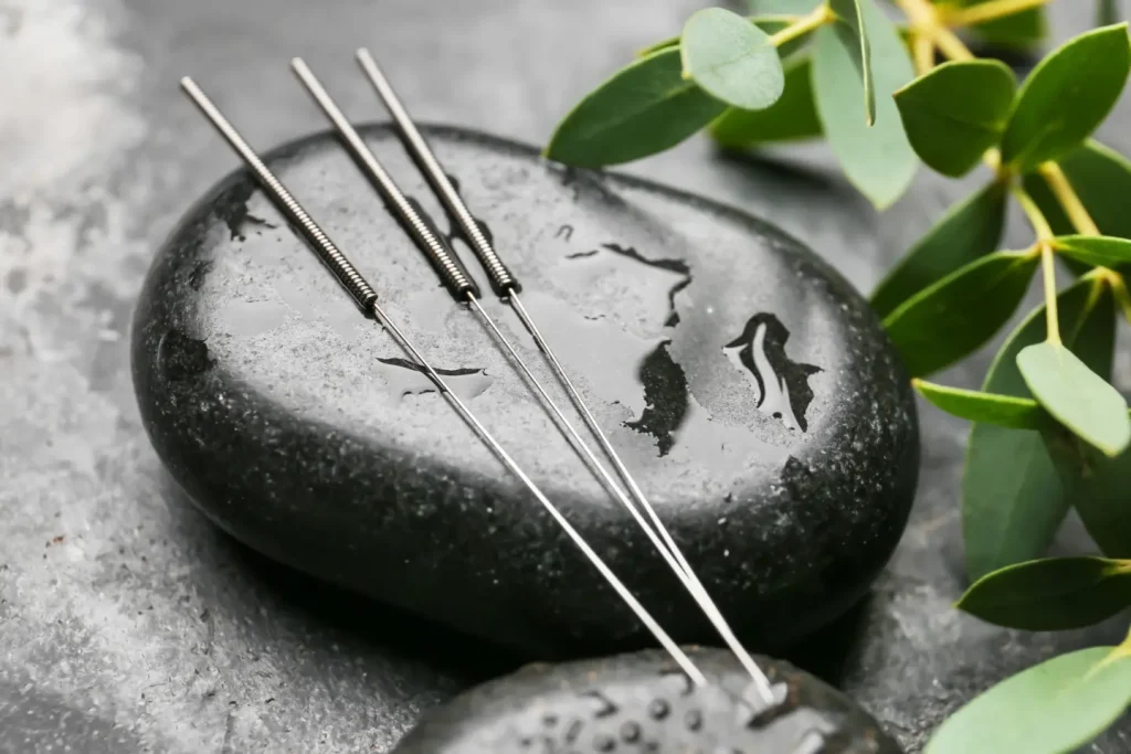 THE ELECTROACUPUNCTURE INSIGHT UNVEILING THE SCIENCE, BENEFITS, AND WHAT TO EXPECT
