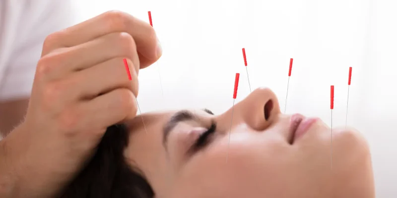 trusted acupuncture services in Malaysia